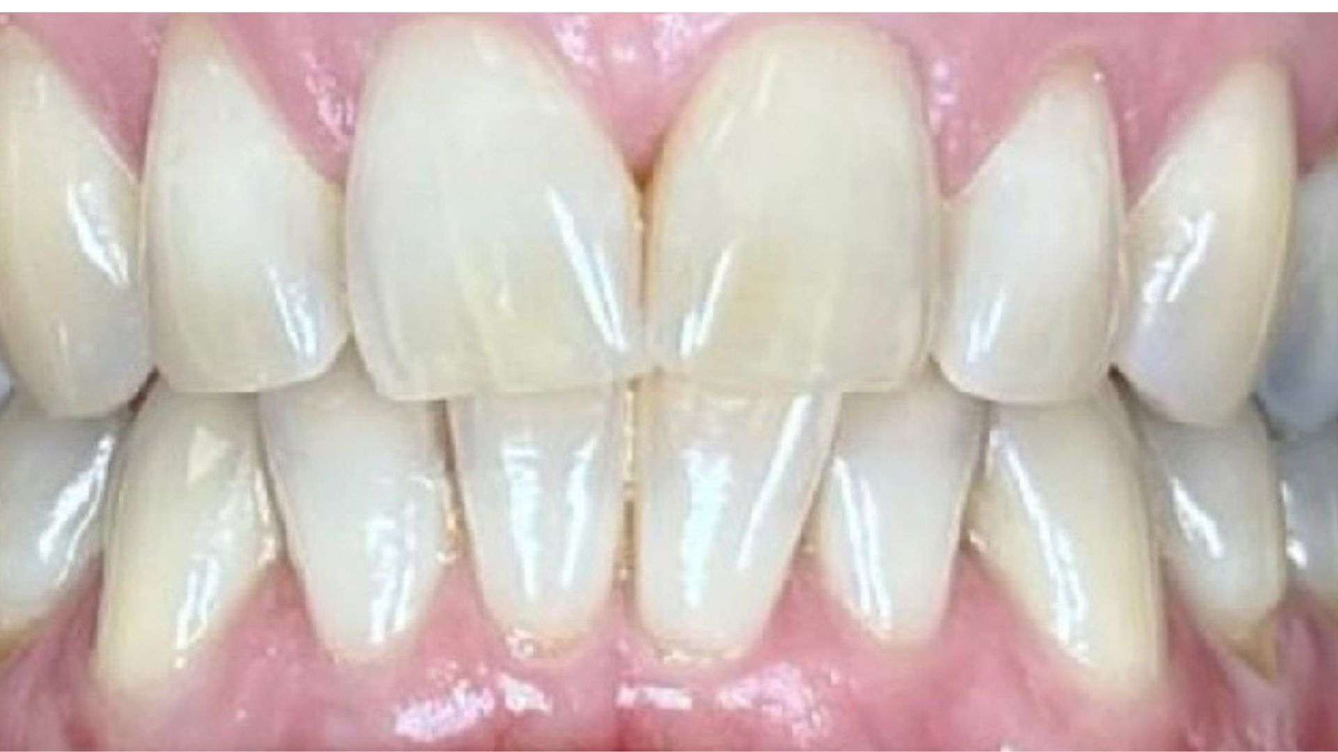 Kind Dental NJ - Smile Gallery