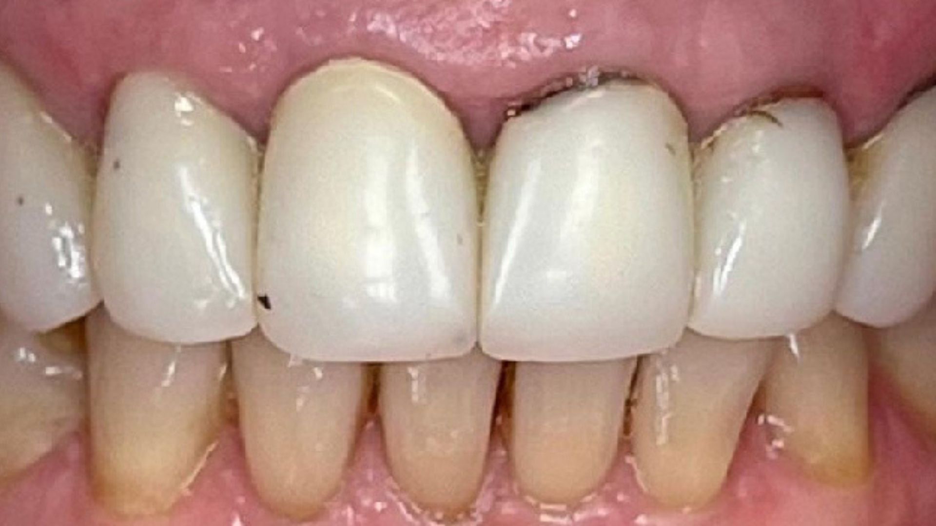 Kind Dental NJ - Smile Gallery