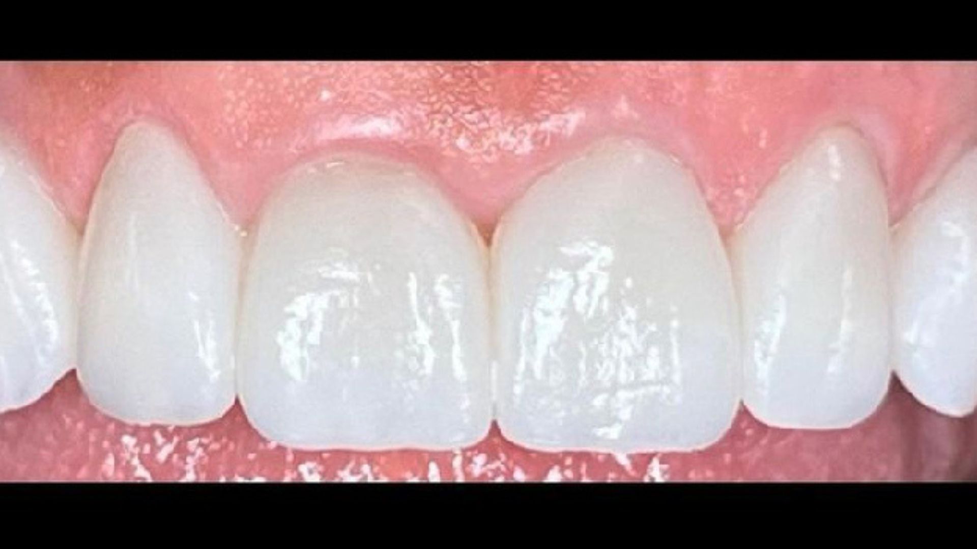before and after 2