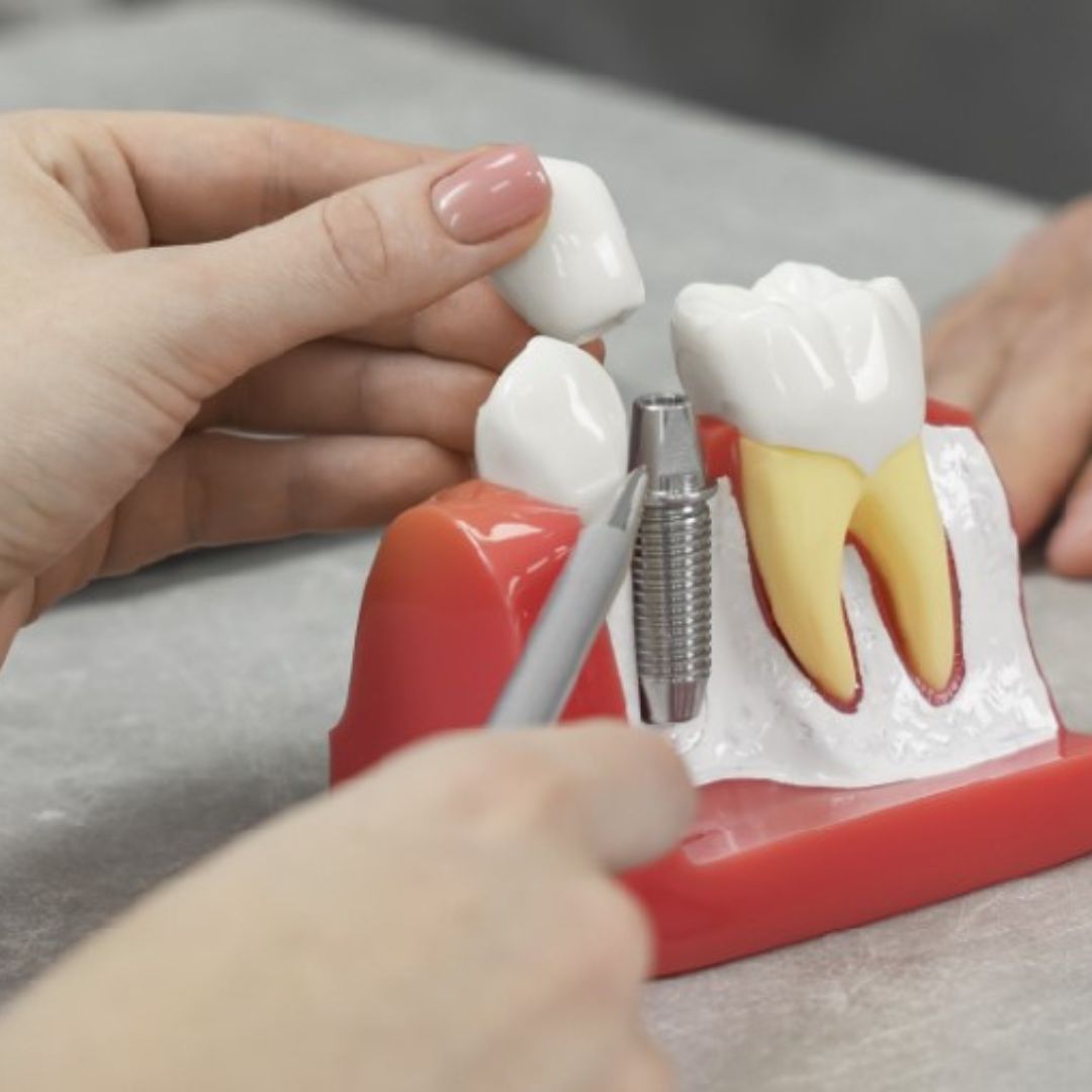 Preventative Care Dentistry at Kind Dental in Scotch Plains