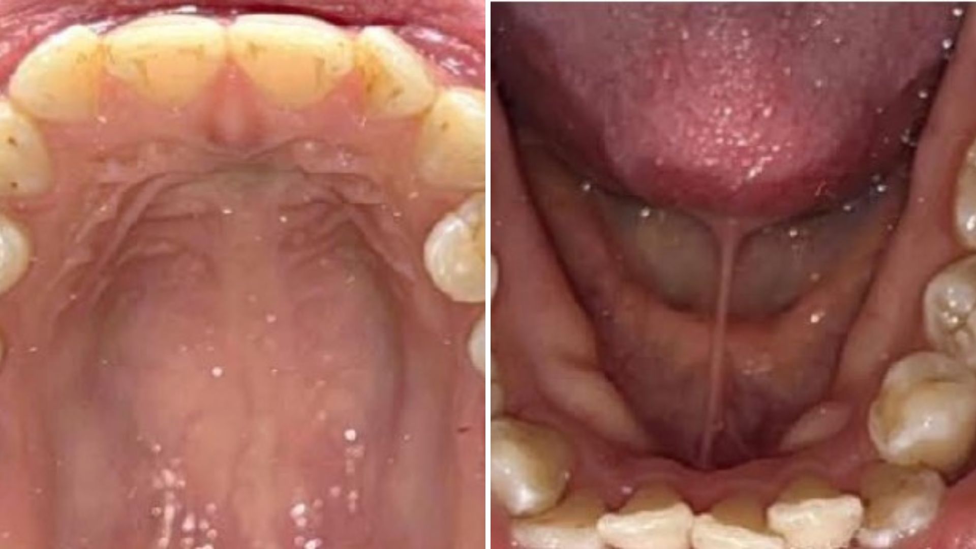 Kind Dental NJ - Smile Gallery