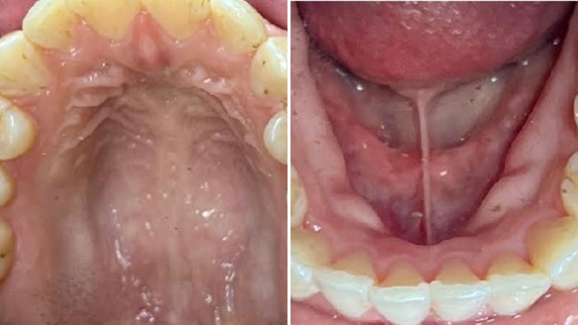 before and after 2