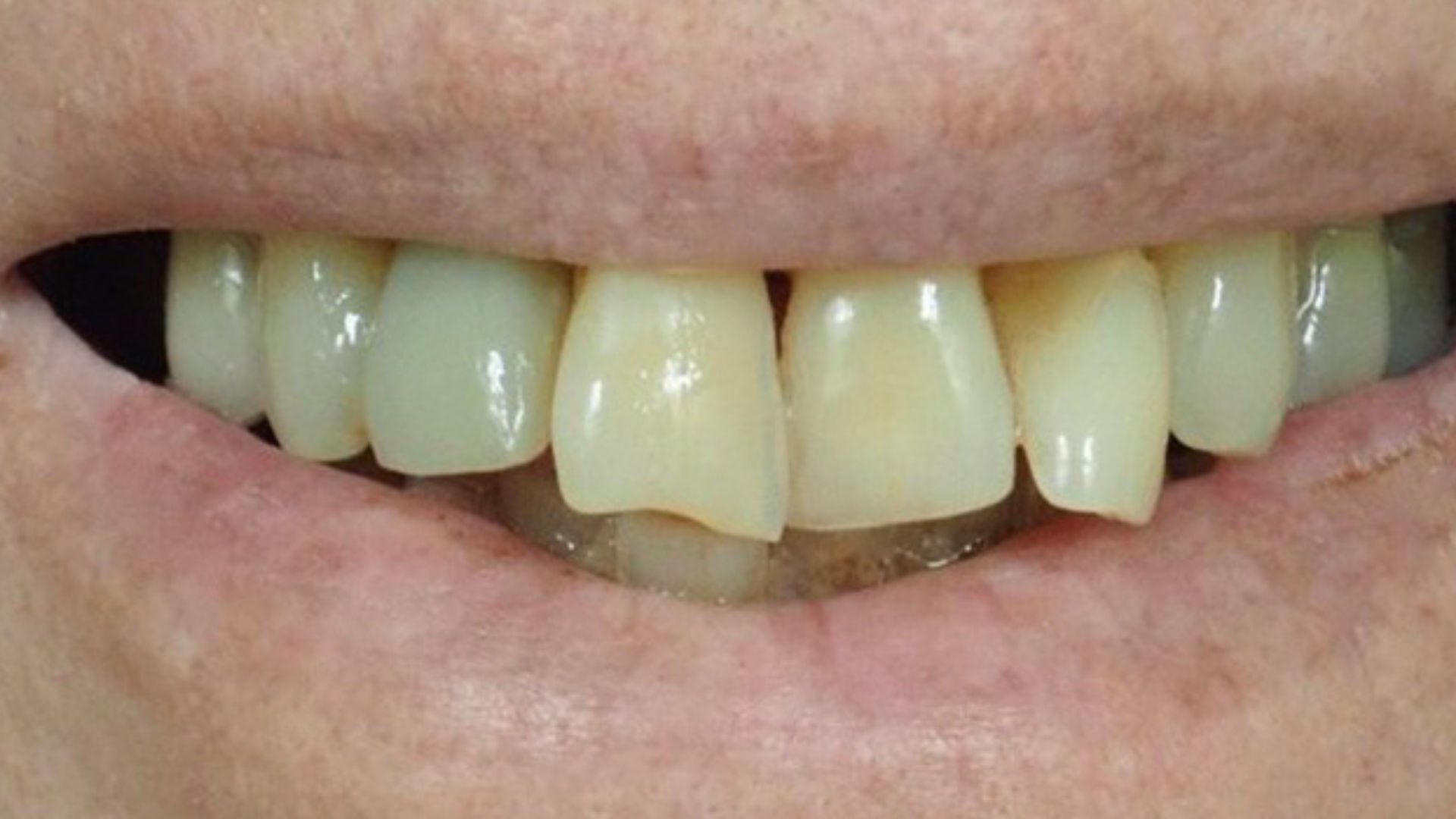 Kind Dental NJ - Smile Gallery