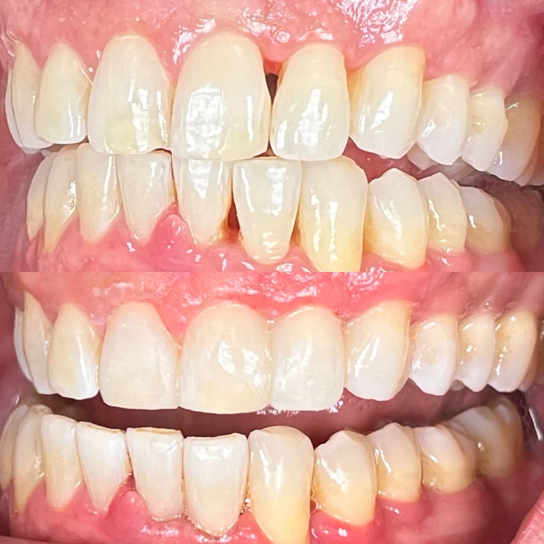 Kind Dental B&A's for Website