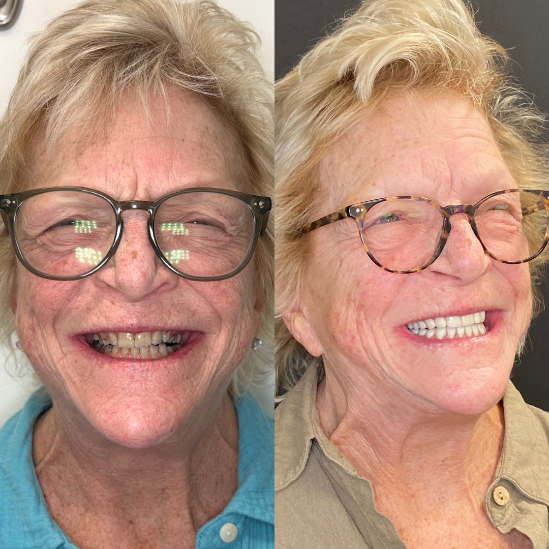 Kind Dental B&A's for Website (1)