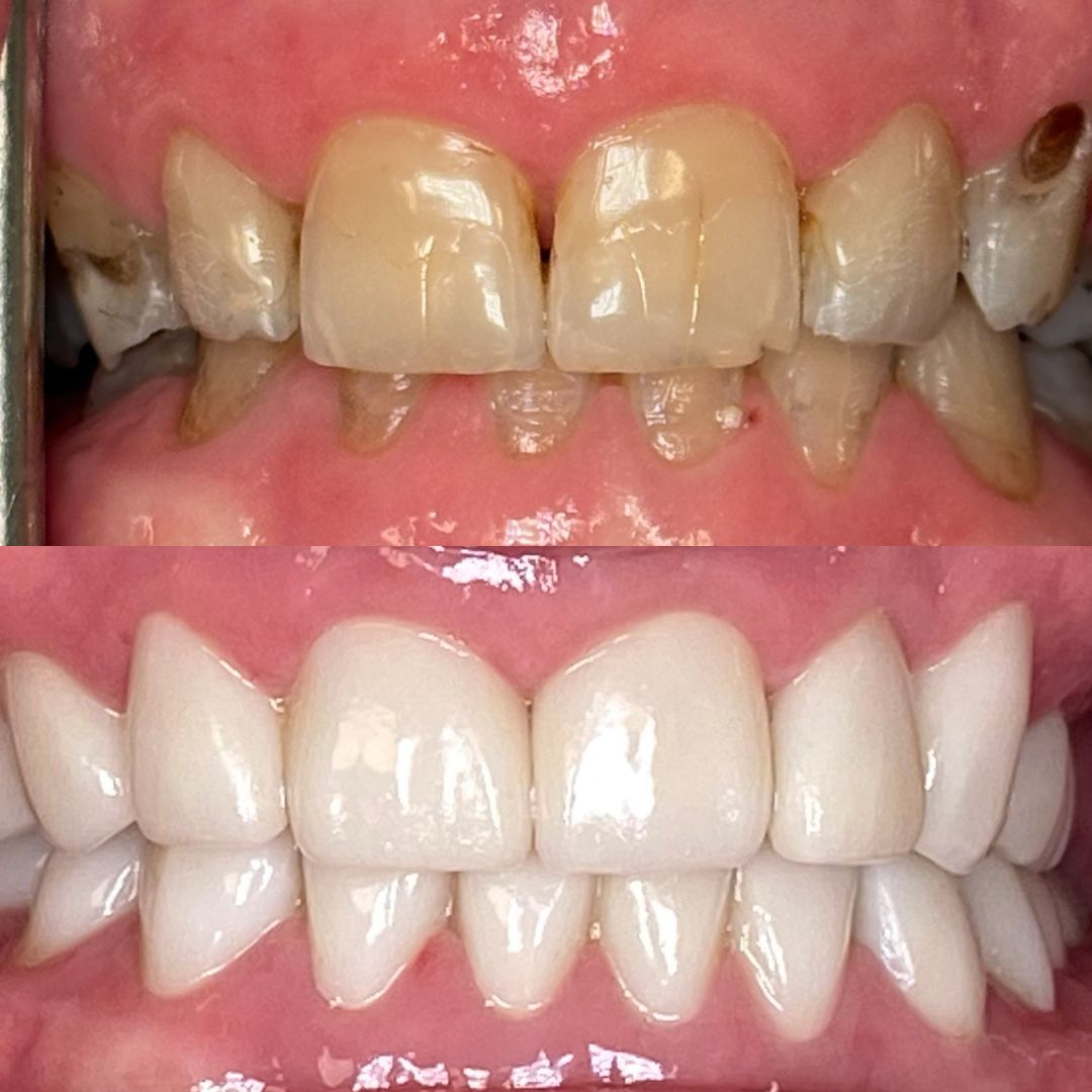 Kind Dental B&A's for Website (2)