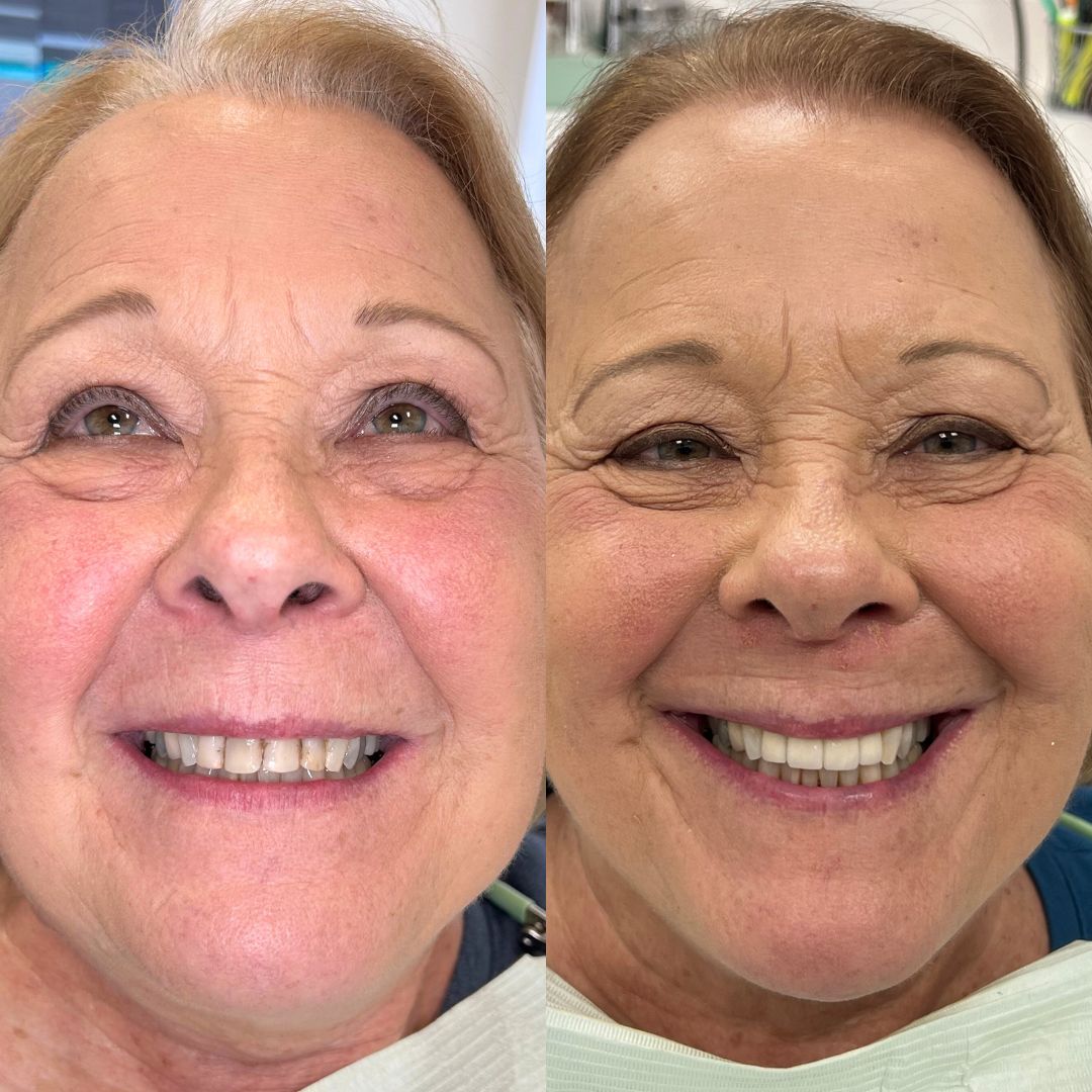 Kind Dental B&A's for Website (8)