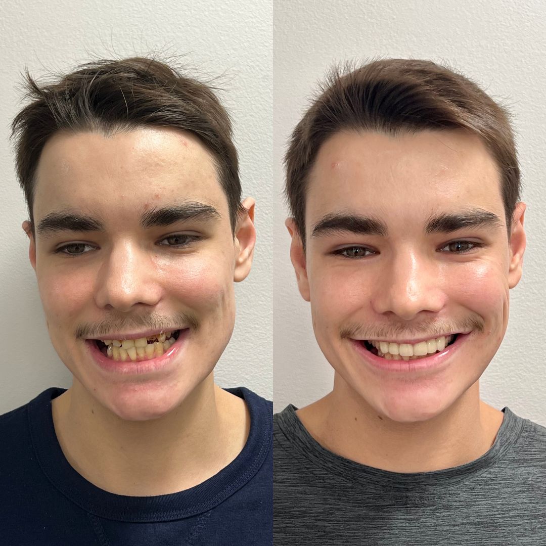 Kind Dental B&A's for Website (9)