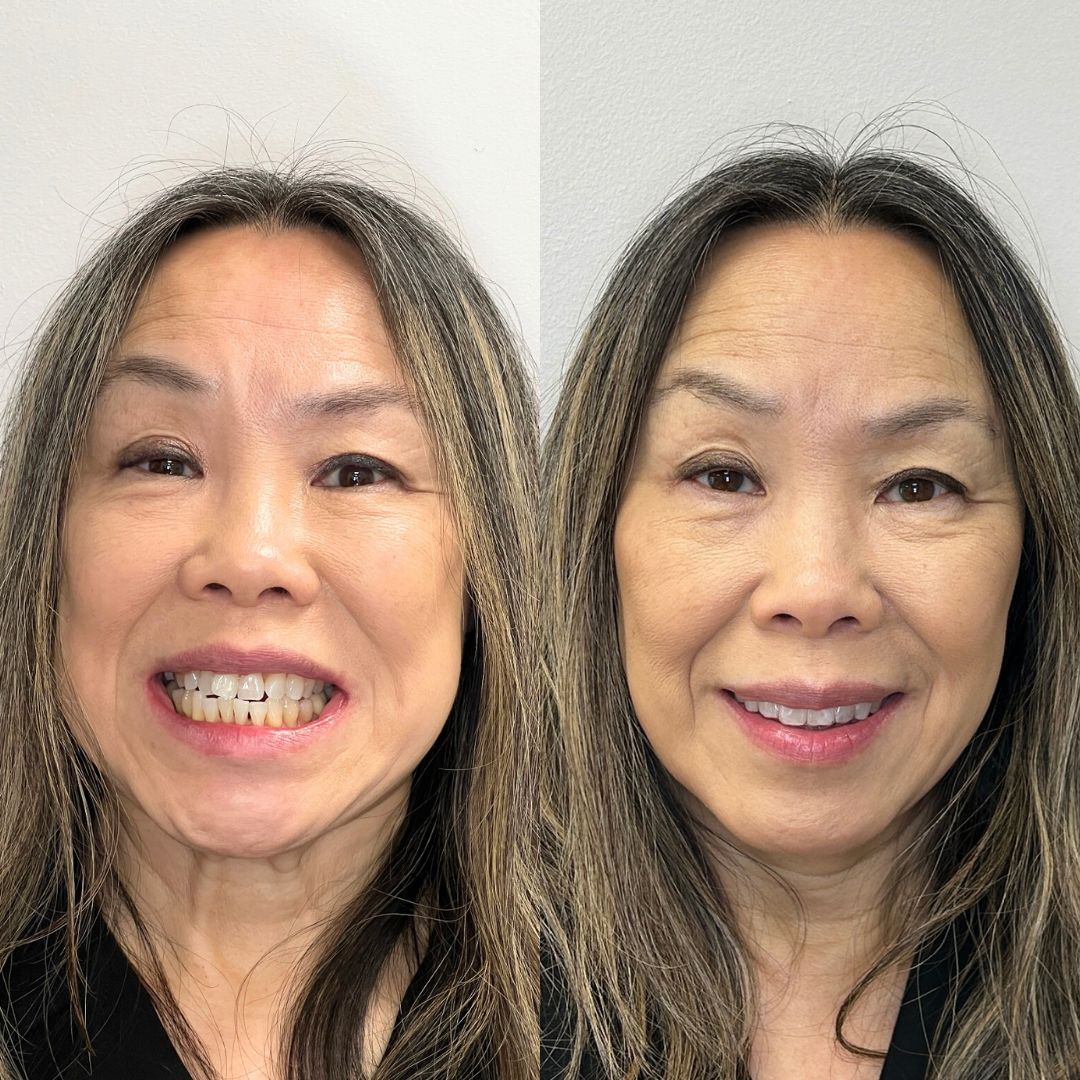 Kind Dental B&A's for Website